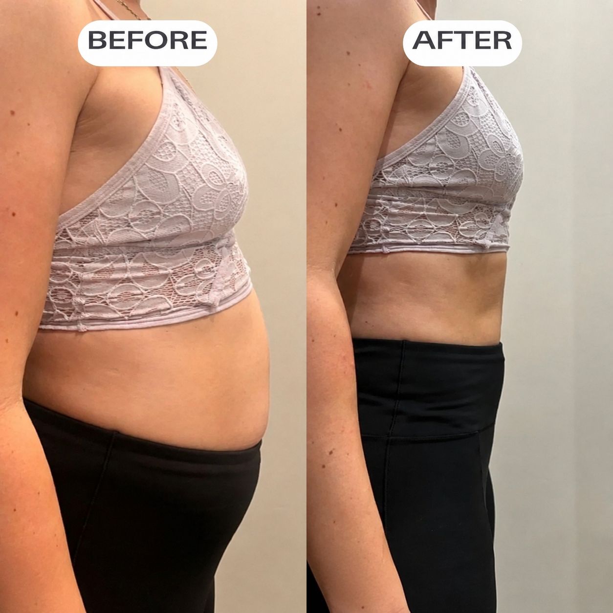A Dose For Bloating