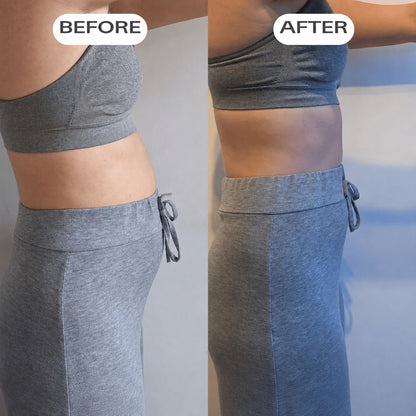 A Dose For Bloating