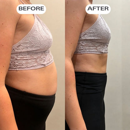 A Dose For Bloating