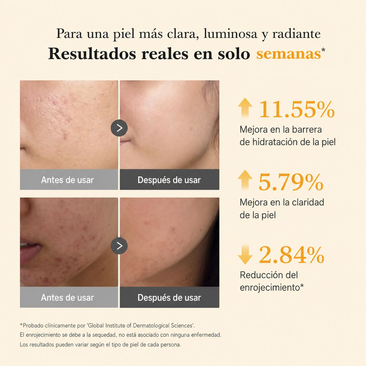 Sérum Coreano Antimanchas Kojic + Turmeric™