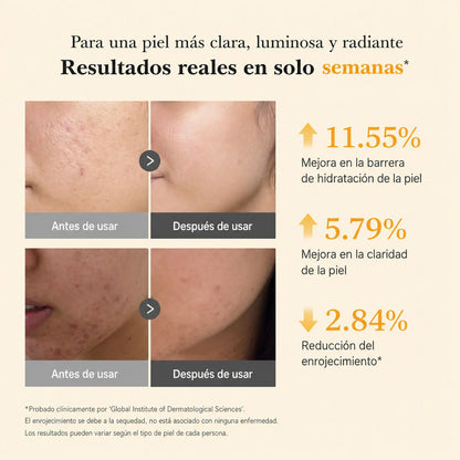 Sérum Coreano Antimanchas Kojic + Turmeric™