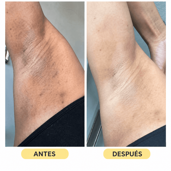 Testimonio 2
