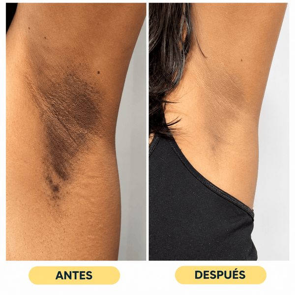 Testimonio 3