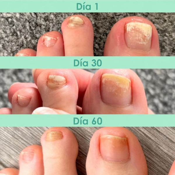 FBP testimonio 307